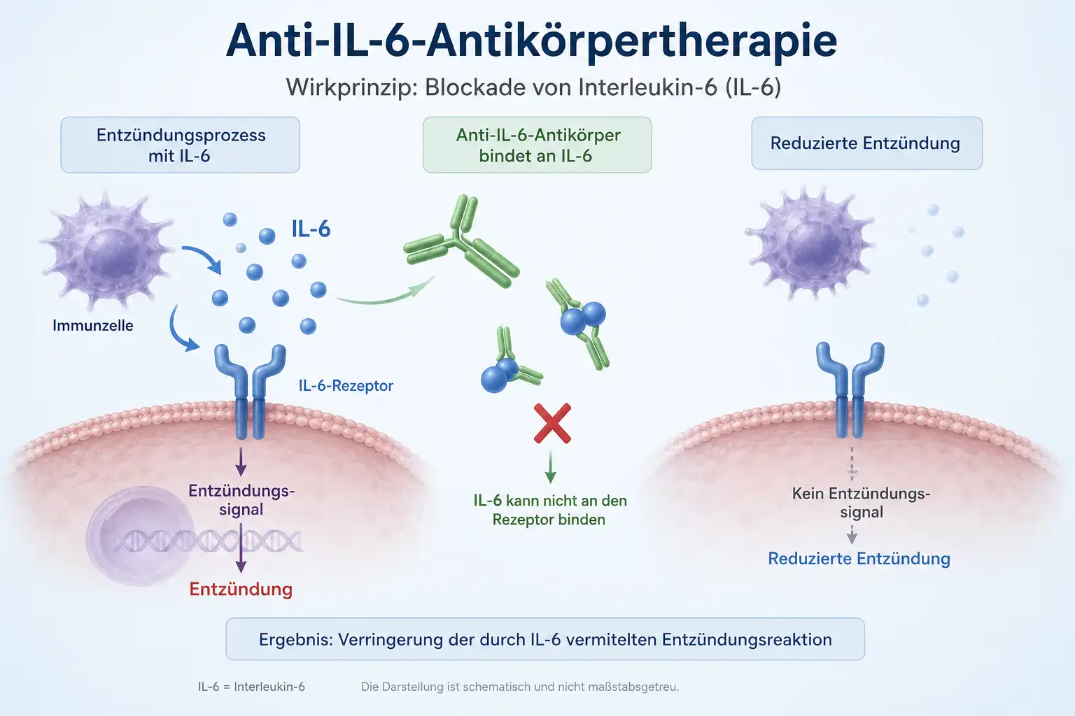 Anti-IL-6 Antibody Therapy: From Filing to Finished Text